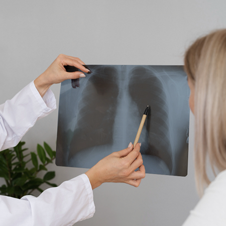 Как распознать и предупредить пневмонию